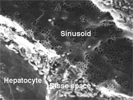 Μικρολάχνες ηπατοκυττάρων στον περικολποειδή χώρο του Disse